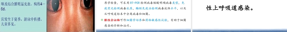 急性上呼吸道感染吴慧毅(最终版).pptx