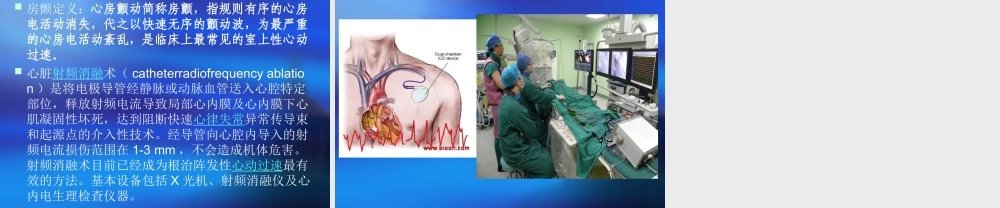 房颤病人的业务查.ppt
