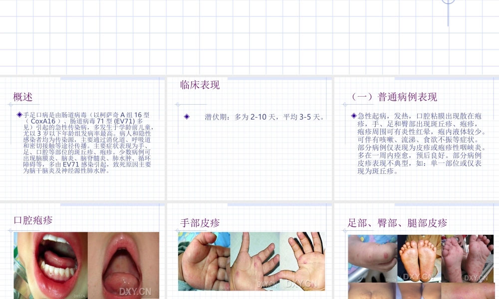 手足口病诊疗指南(2010年版).ppt