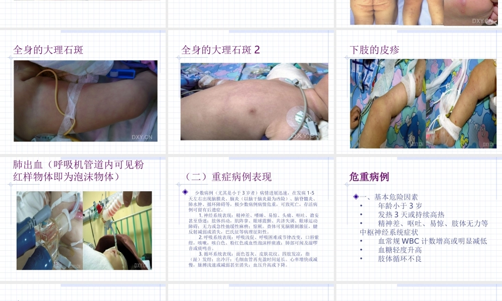 手足口病诊疗指南(2010年版).ppt