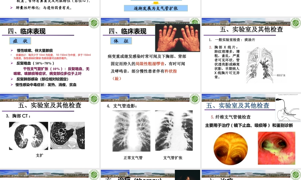 支气管扩张症改.ppt