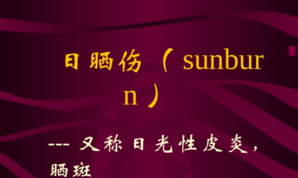 日晒伤(sunburn)要点.ppt