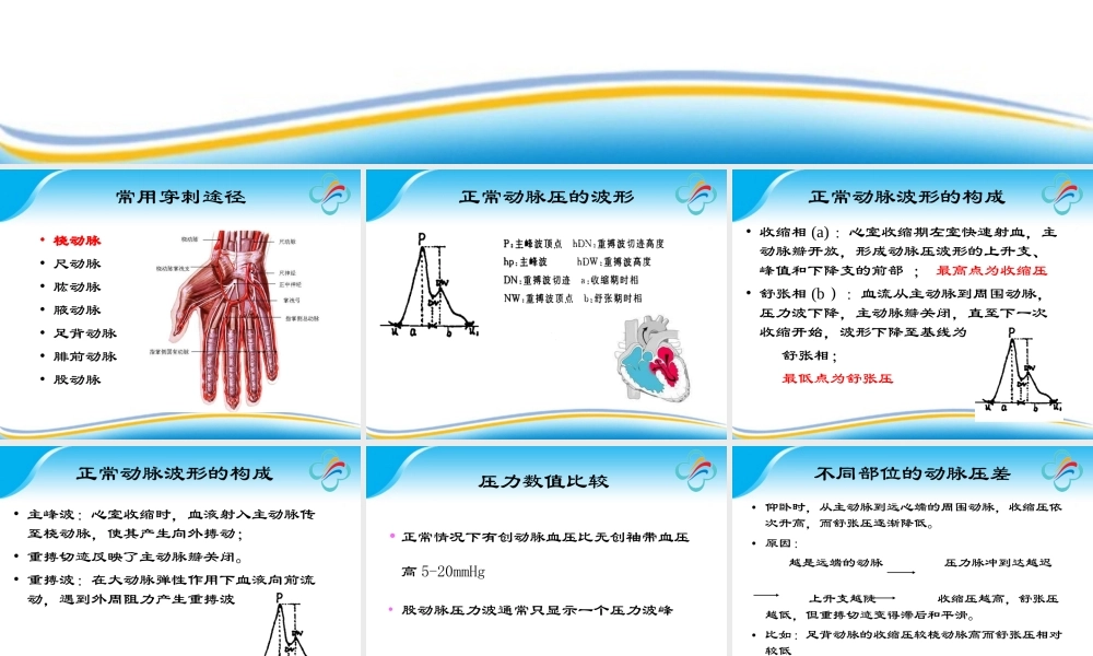 有创动脉血压监测的探讨.ppt
