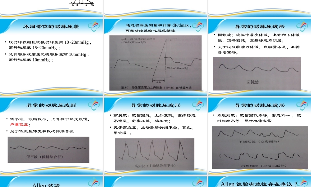 有创动脉血压监测的探讨.ppt