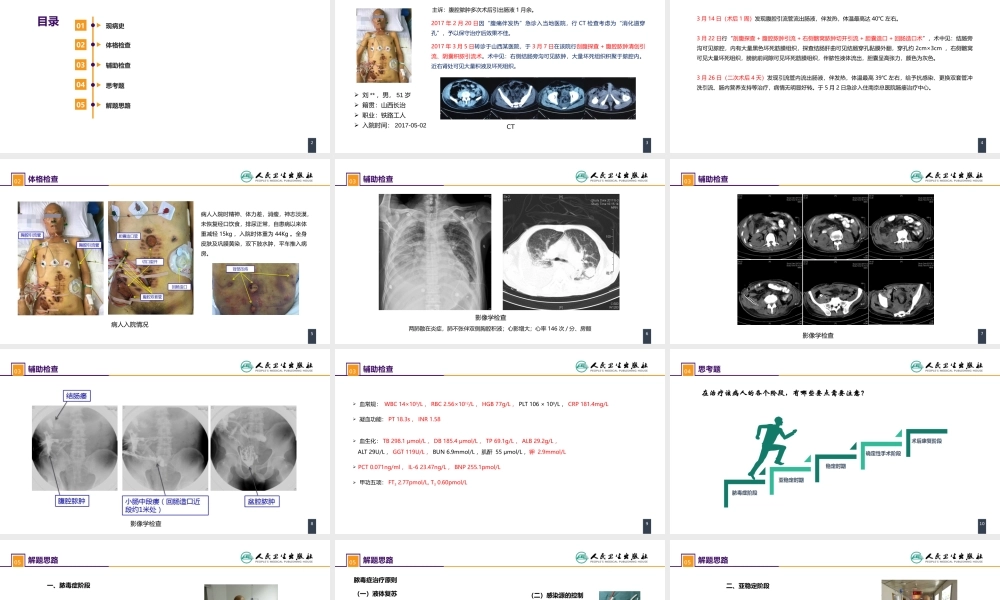 案例分析-肠瘘、腹腔感染合并脓毒症.pptx