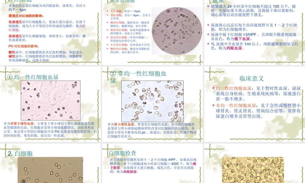 尿液有形成分及尿分析仪.ppt