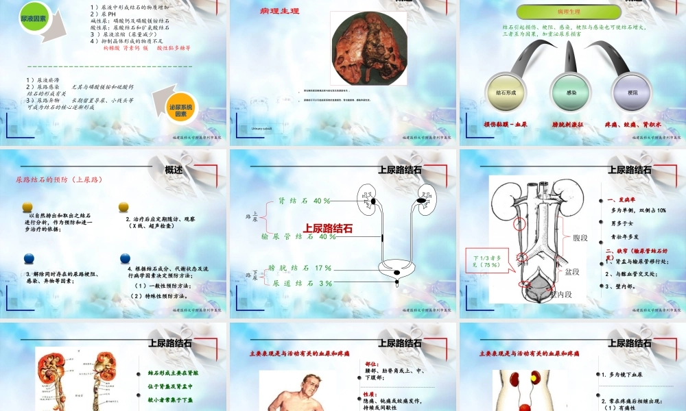 尿石症讲稿-庄志明.ppt
