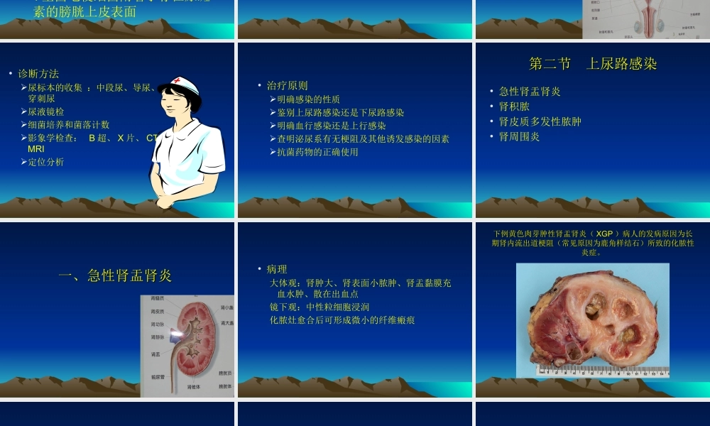 泌尿、男生殖系统感染-胡万里.ppt