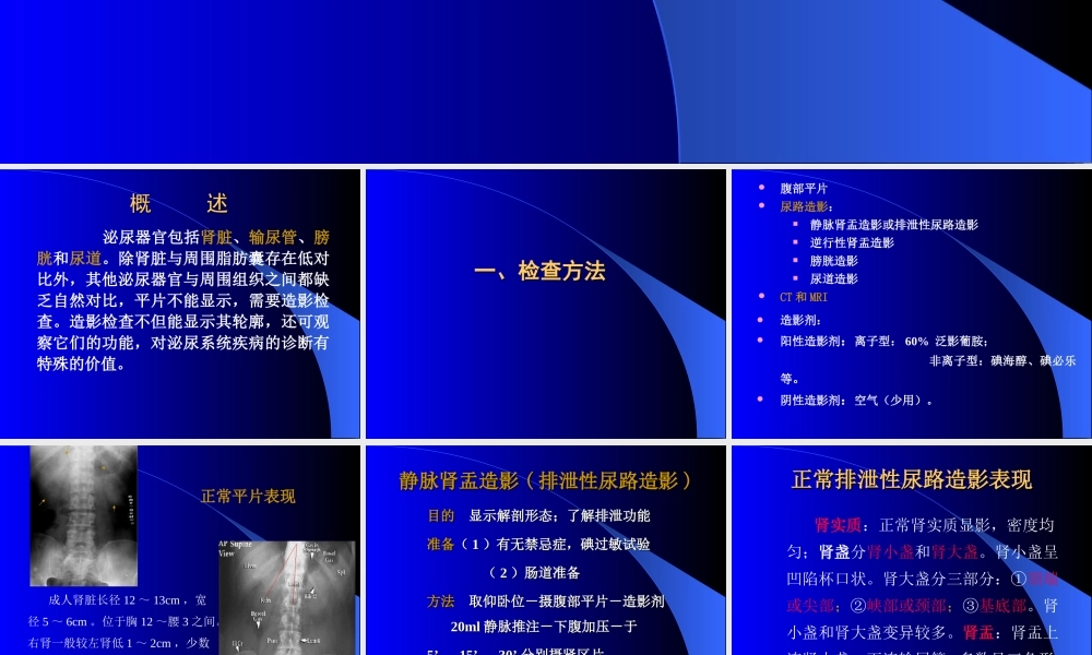 泌尿检查方法及结石.ppt