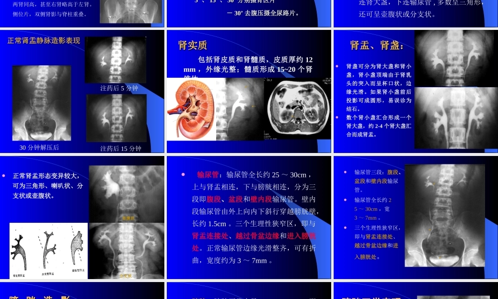 泌尿检查方法及结石.ppt