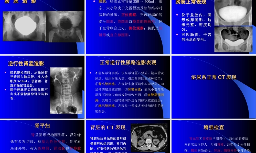 泌尿检查方法及结石.ppt