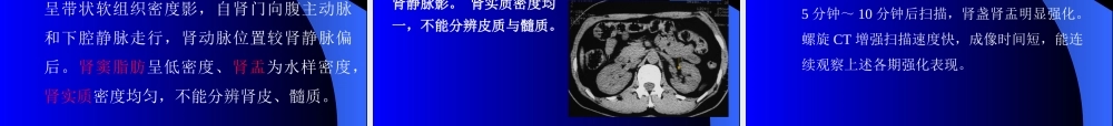 泌尿检查方法及结石.ppt