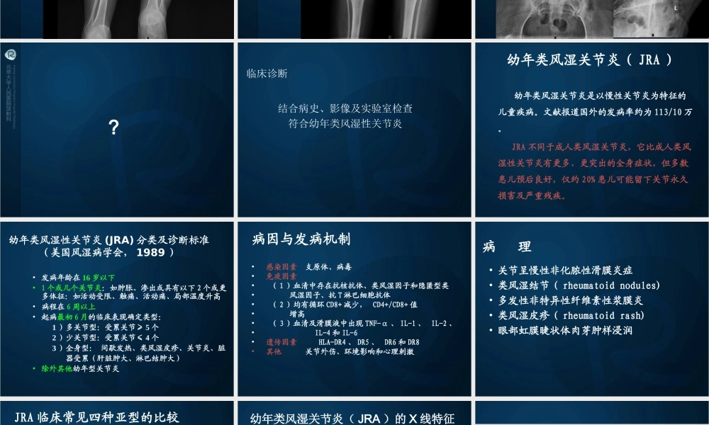 幼年类风湿性关节炎分析.ppt