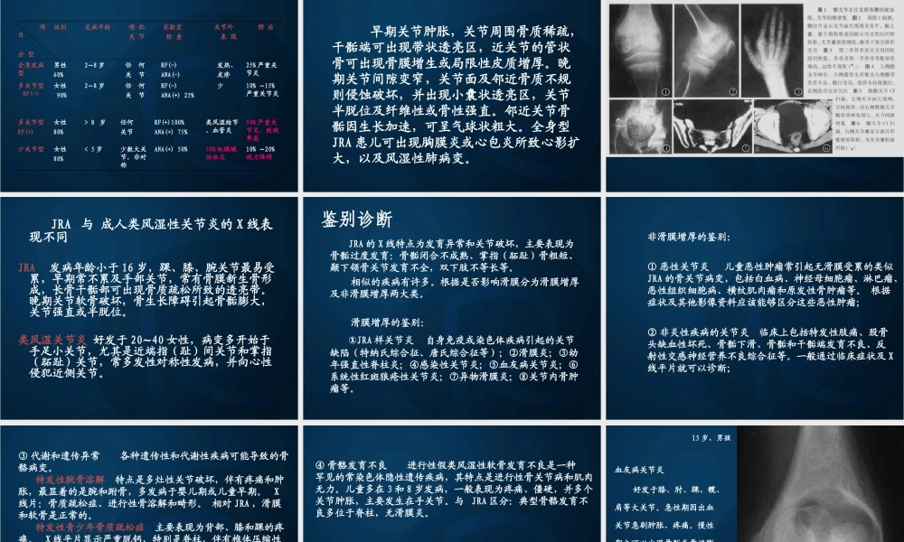 幼年类风湿性关节炎分析.ppt