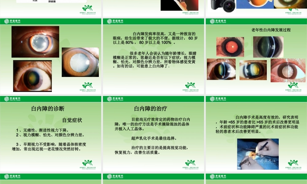 年龄相关性眼病-普瑞眼科医院-艾碧君院长-2014-09-16.ppt