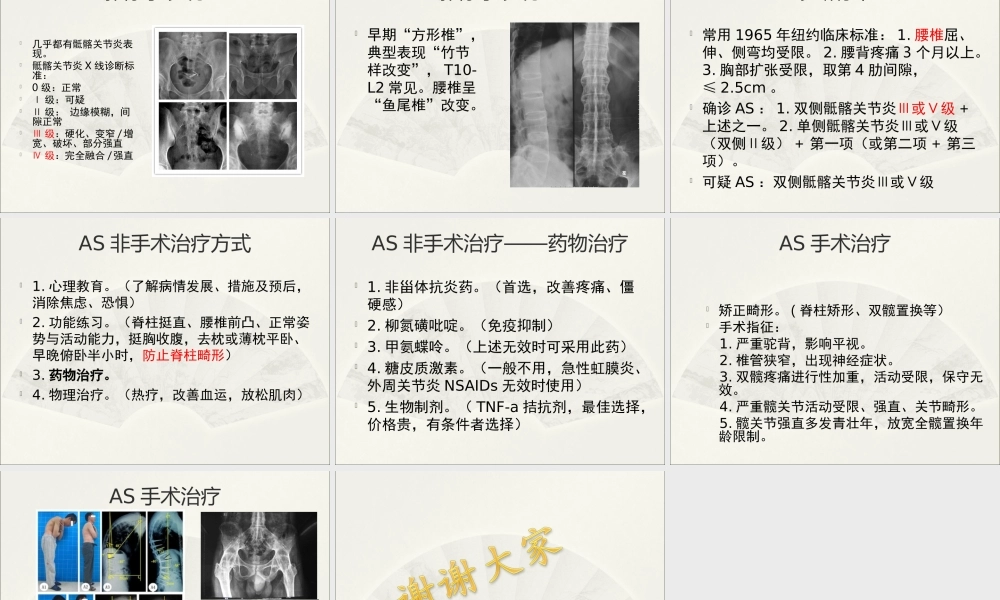强直性脊柱炎综述.ppt