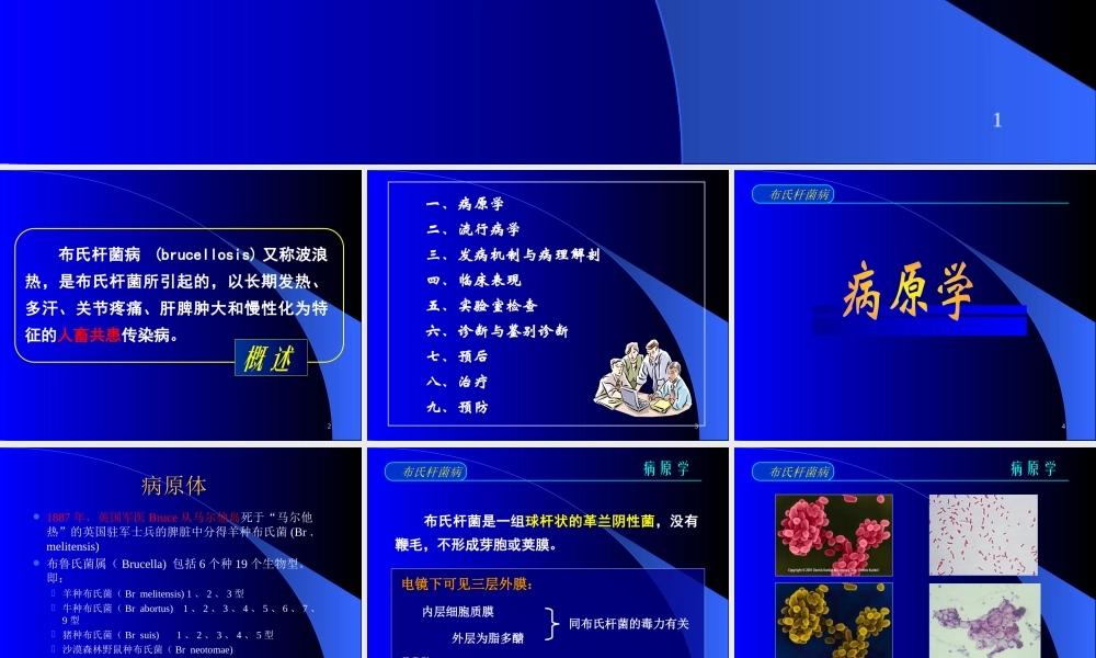 布氏杆菌病诊疗.ppt