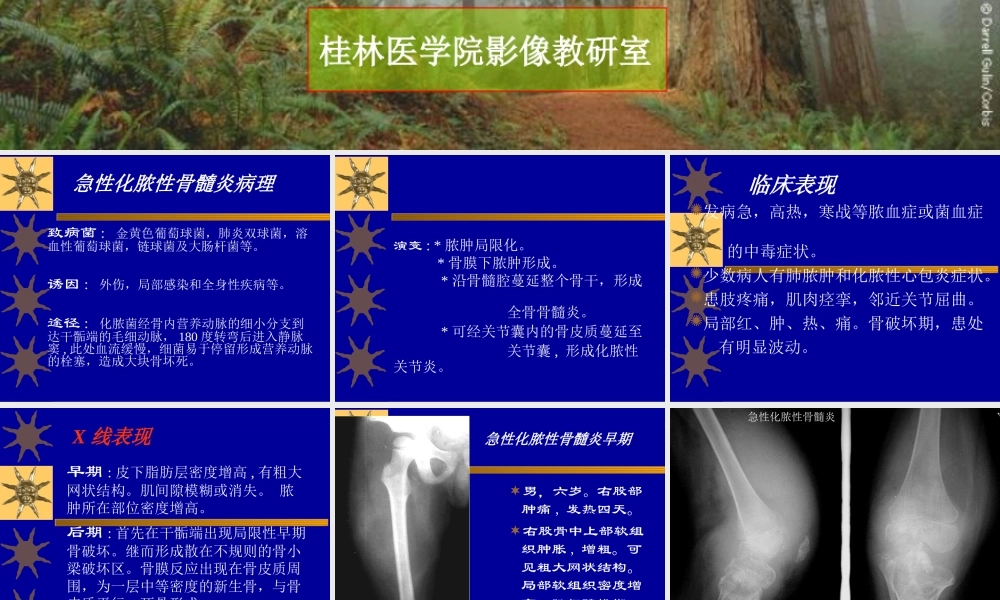 常见病2(感染).ppt