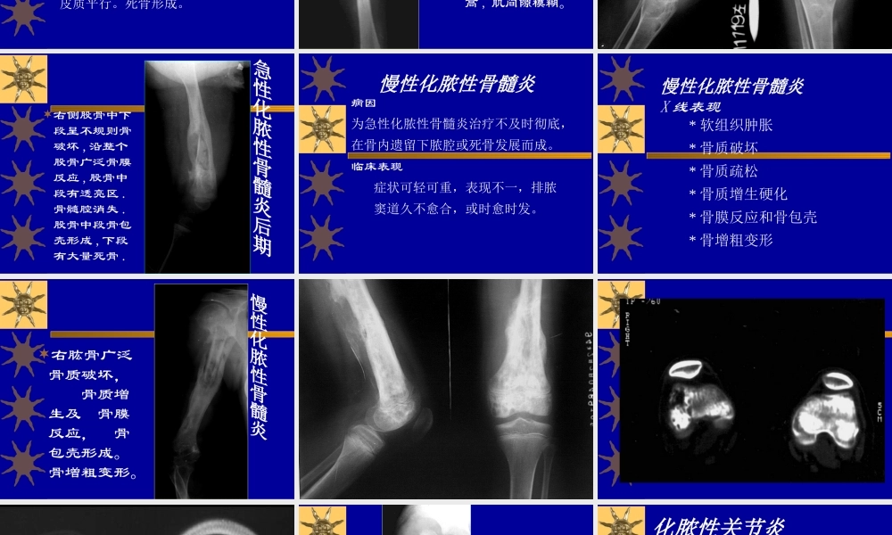 常见病2(感染).ppt