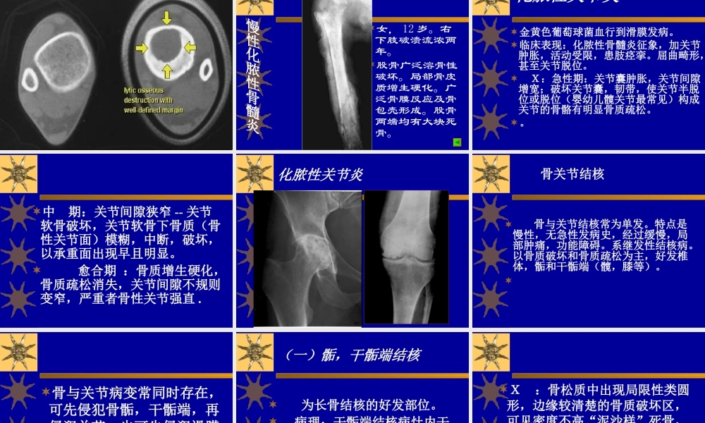 常见病2(感染).ppt