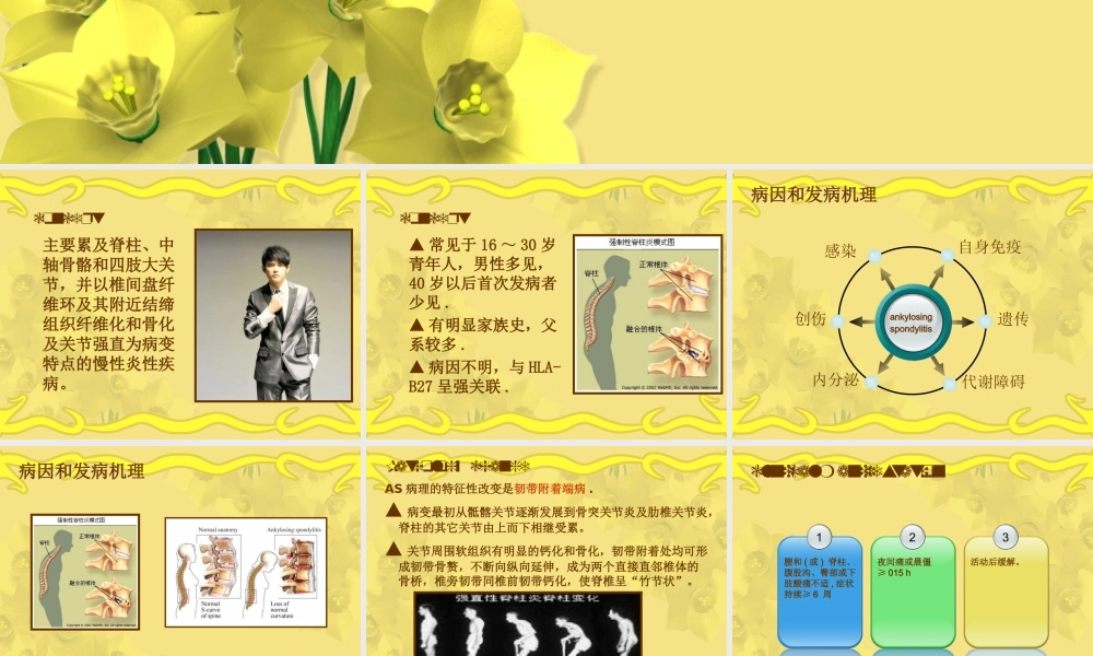 强直性脊柱炎1详解.ppt