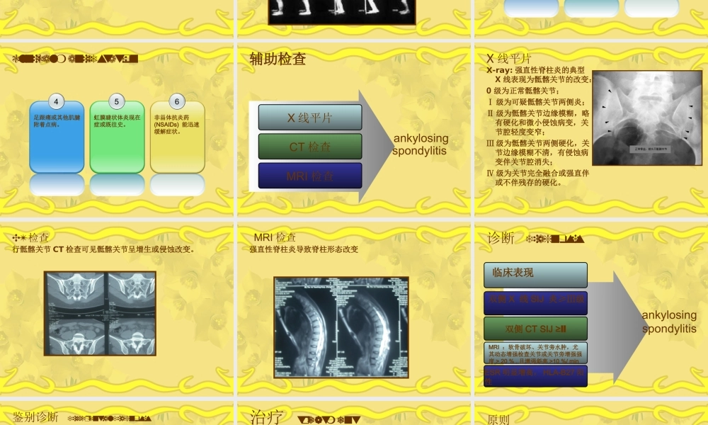 强直性脊柱炎1详解.ppt
