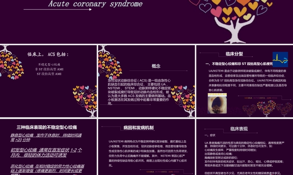 急性冠脉综合征-第八版教材同步PPT.ppt