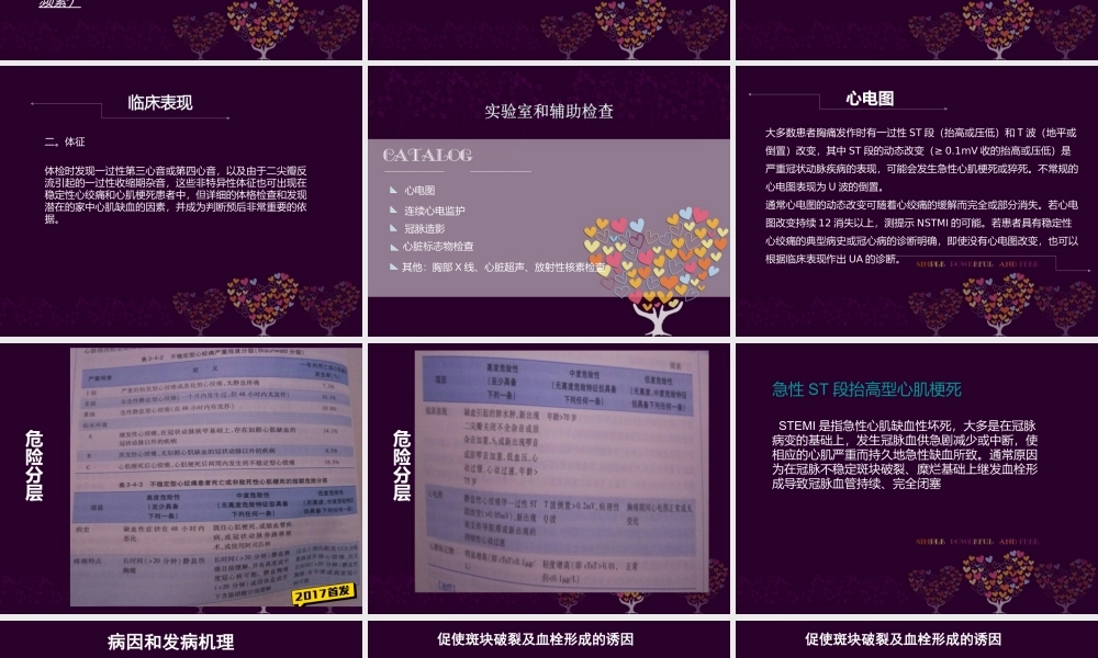 急性冠脉综合征-第八版教材同步PPT.ppt