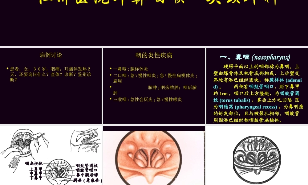 急性化脓性扁桃体炎.ppt