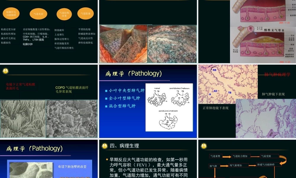 慢性阻塞性肺病(吴奎).ppt