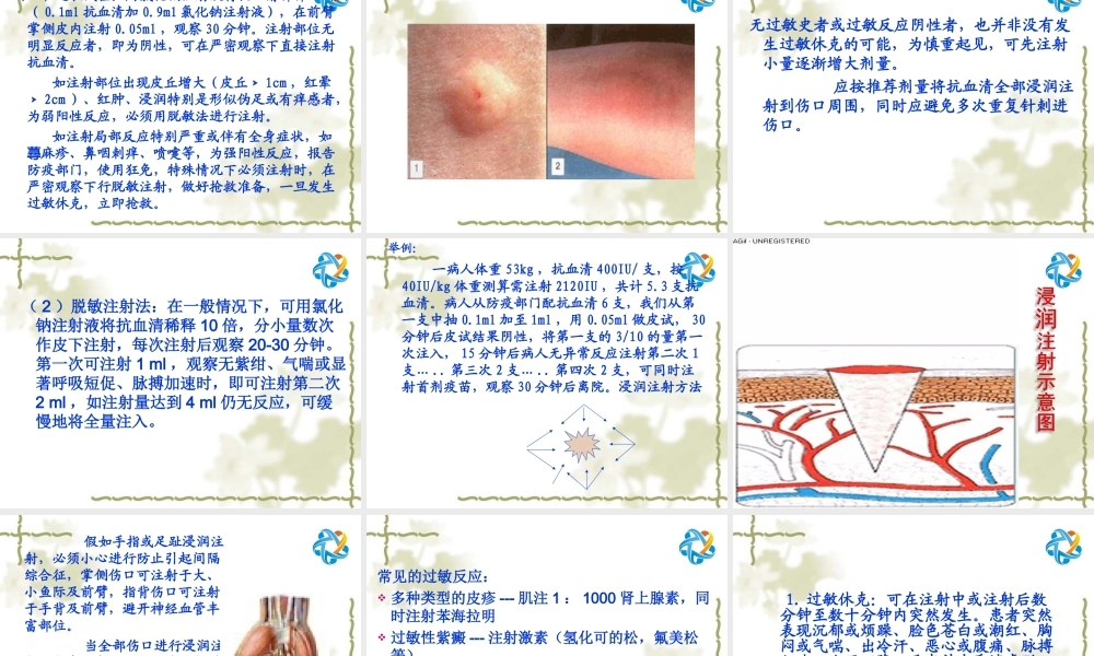 抗狂犬病血清操作要点.ppt