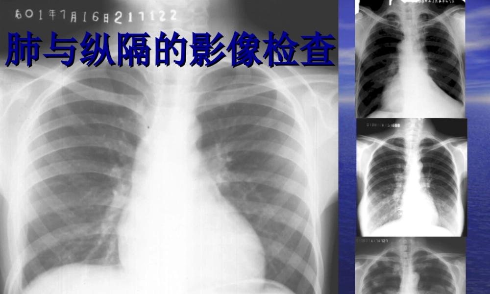 教你如何看肺部CT.ppt