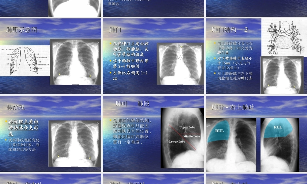 教你如何看肺部CT.ppt