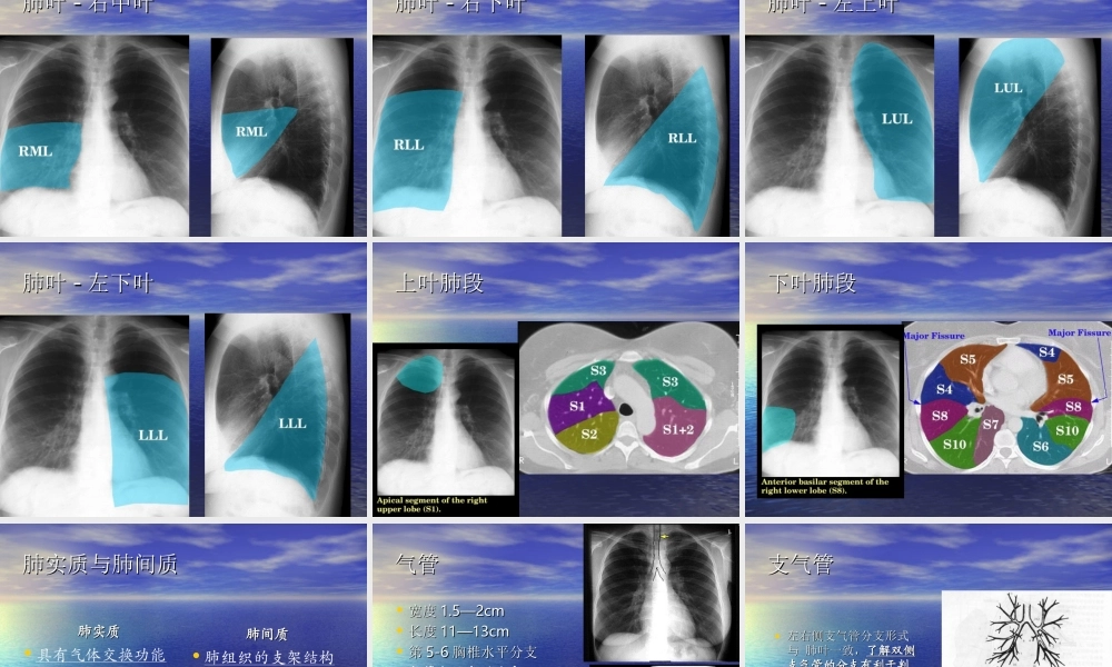 教你如何看肺部CT.ppt