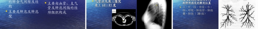 教你如何看肺部CT.ppt