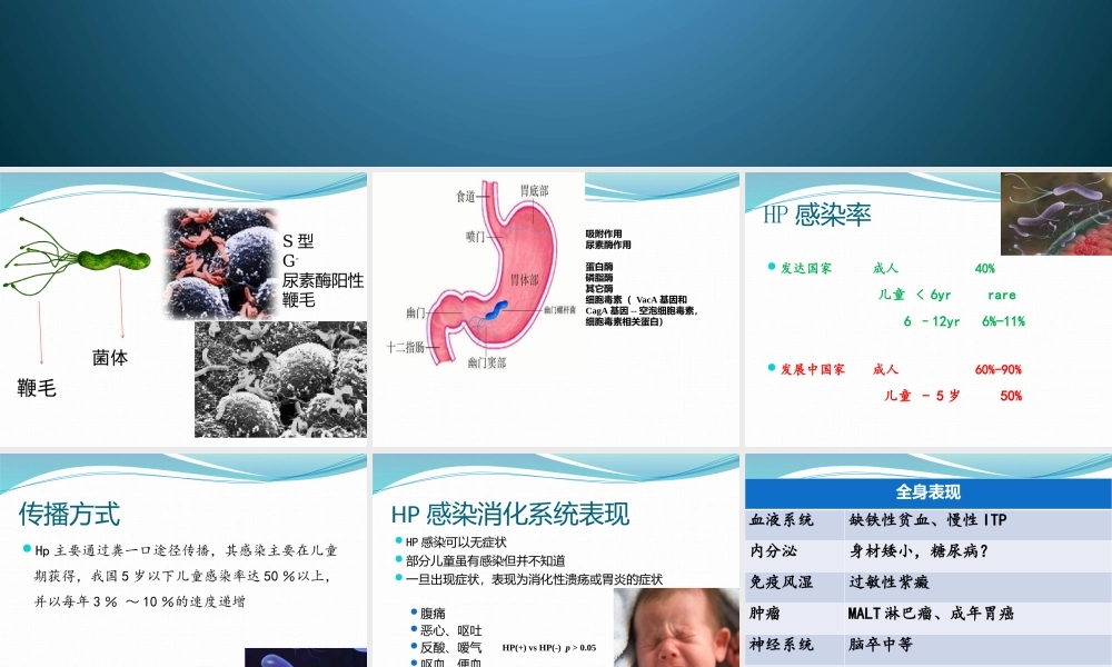 幽门螺杆菌感染.pptx