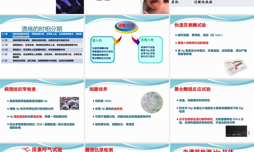 幽门螺杆菌感染.pptx