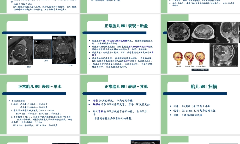 影像学中胎儿磁共振成像技术.ppt