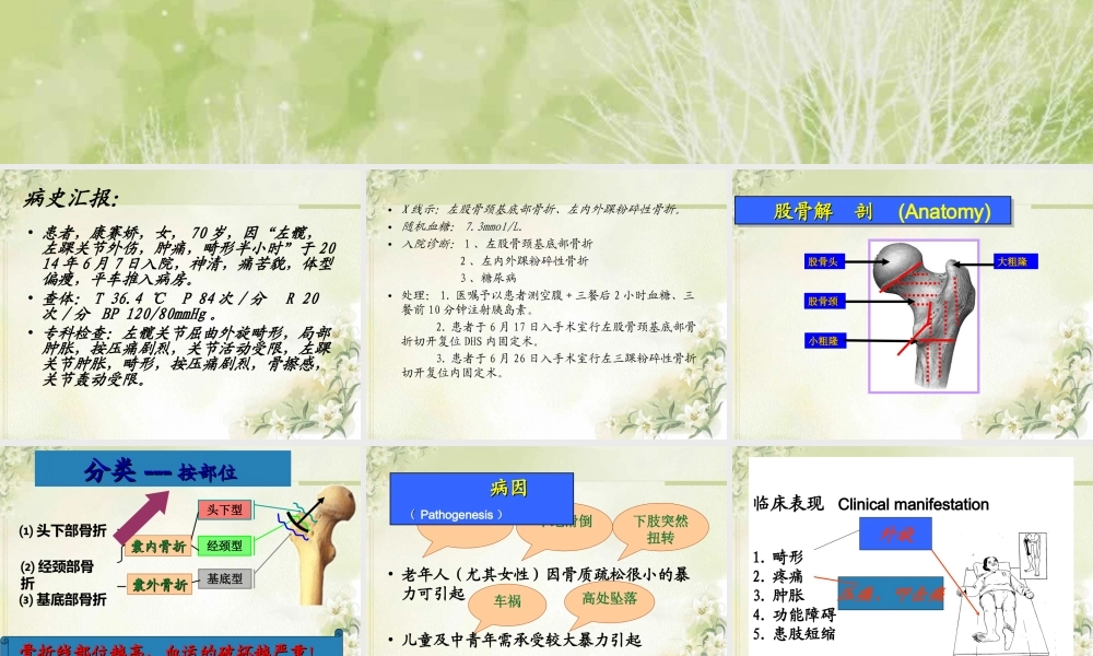 左股骨颈基底部骨折.ppt