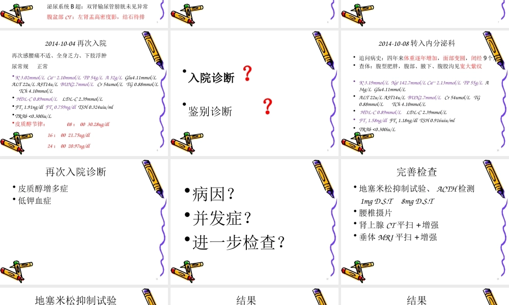 库欣病-例-讨论20151024.ppt