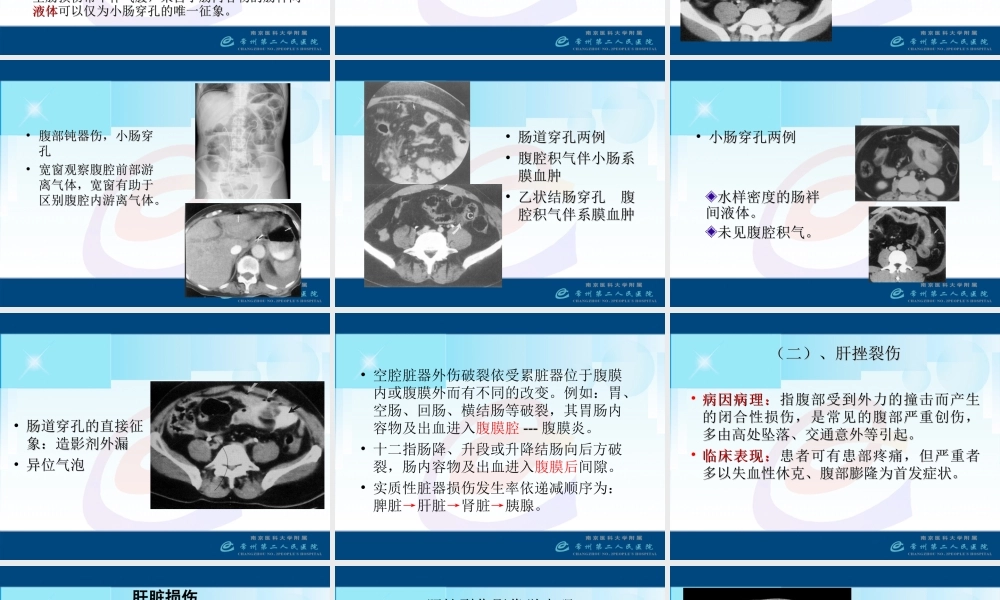 急腹症3-腹部外伤.ppt