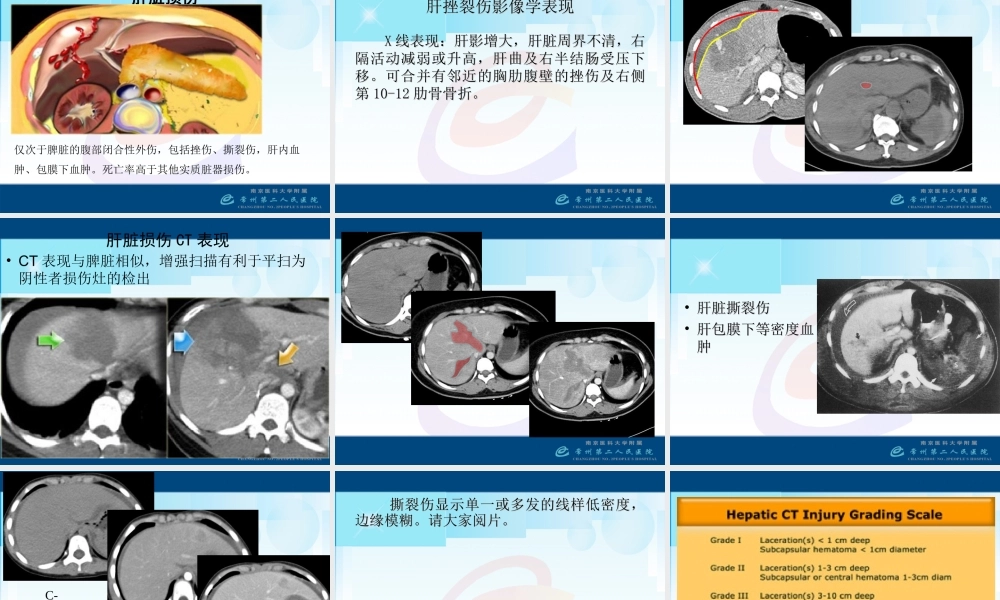 急腹症3-腹部外伤.ppt