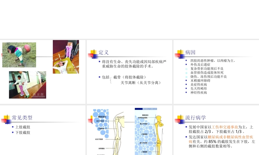 截肢后的康复.ppt