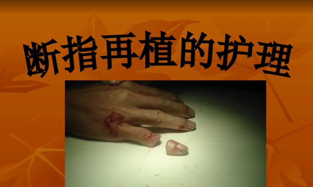 教学查房断肢再植..ppt