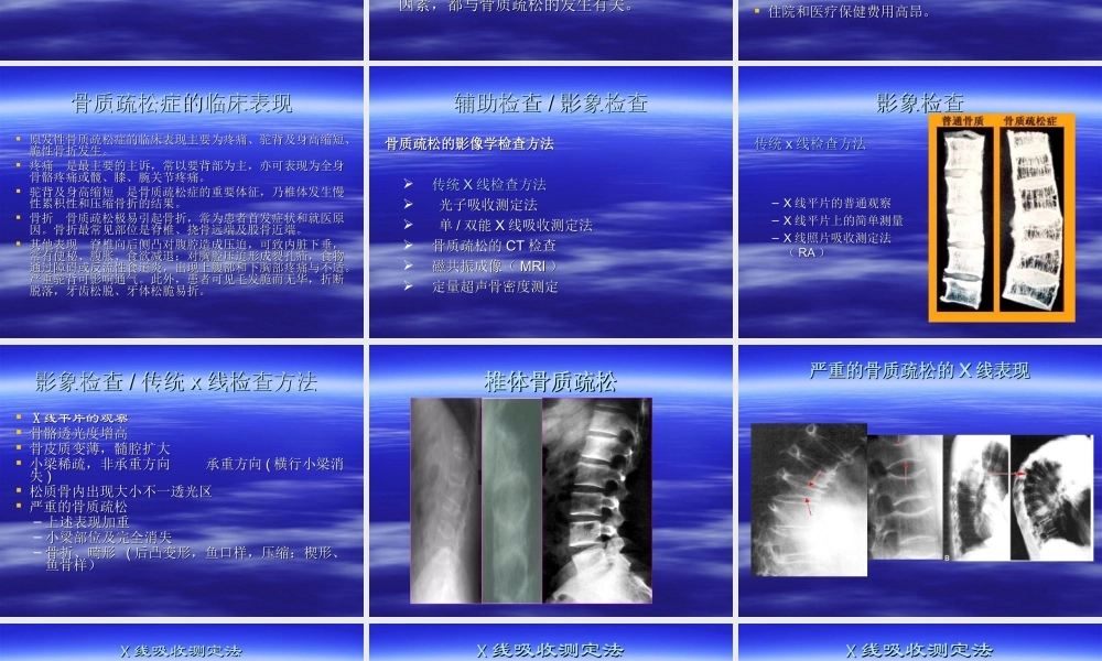 张启富-骨质疏松症.ppt