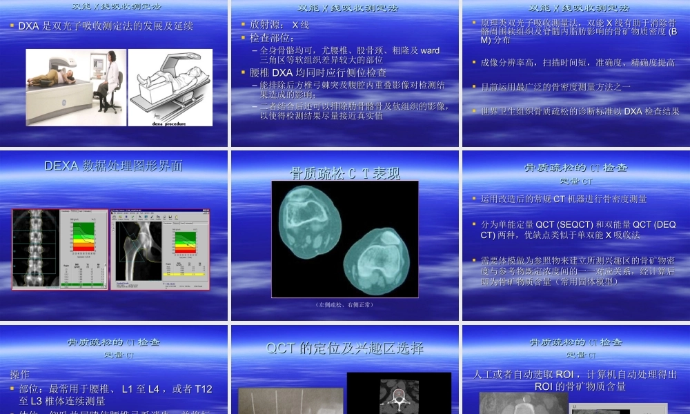 张启富-骨质疏松症.ppt