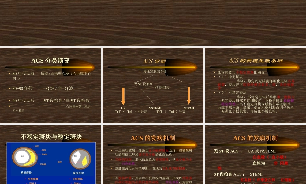 急性冠状动脉综合症(安吉)--副本.ppt