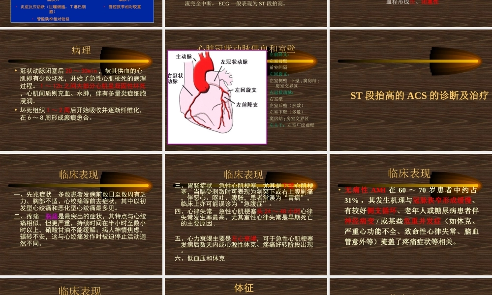 急性冠状动脉综合症(安吉)--副本.ppt
