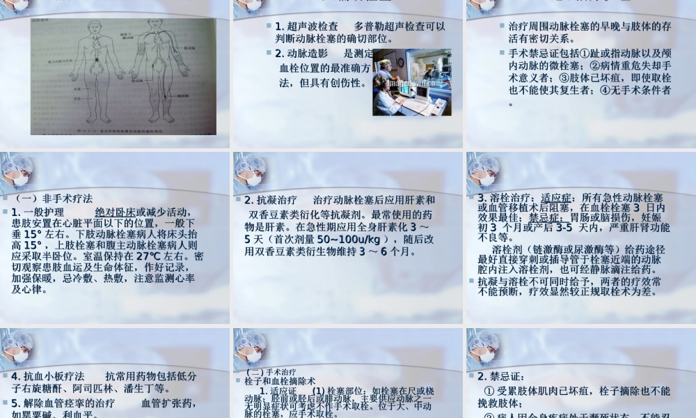 急性动脉栓塞.ppt