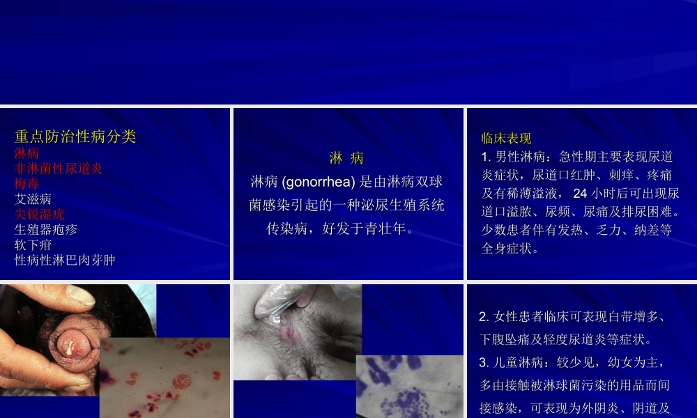 常见性病.ppt
